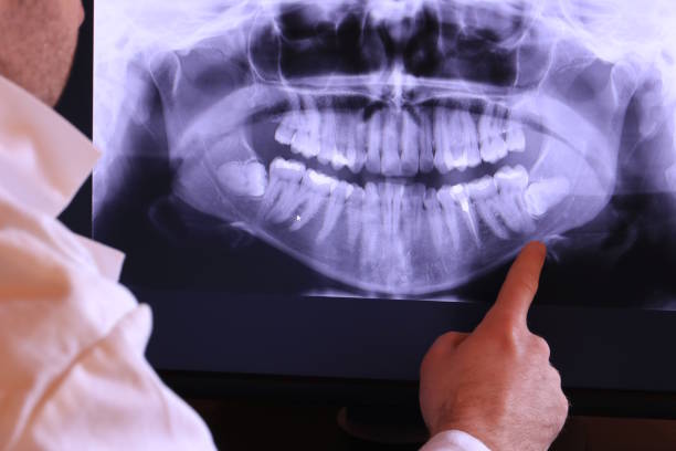 Best Emergency Treatment for Dental Infections or Abscesses in Gregory, SD